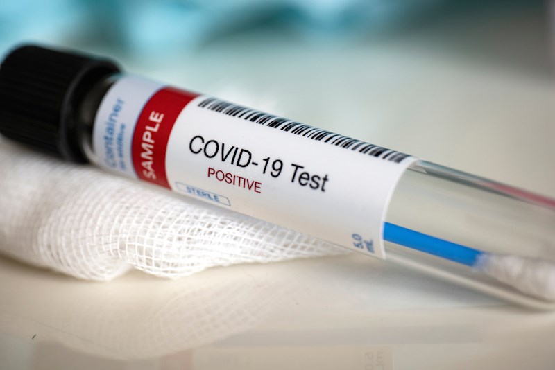 Taiwan To Increase COVID-19 Testing