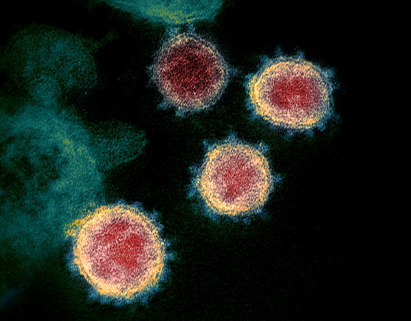 COVID-19 Death Toll In USA Hits 150,000, Virus Getting Closer to Trump