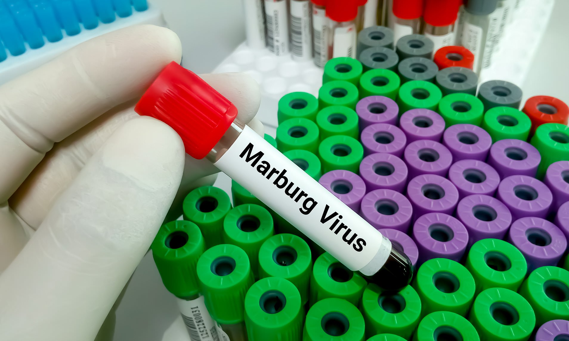 Man in Guinea died by Marburg virus
