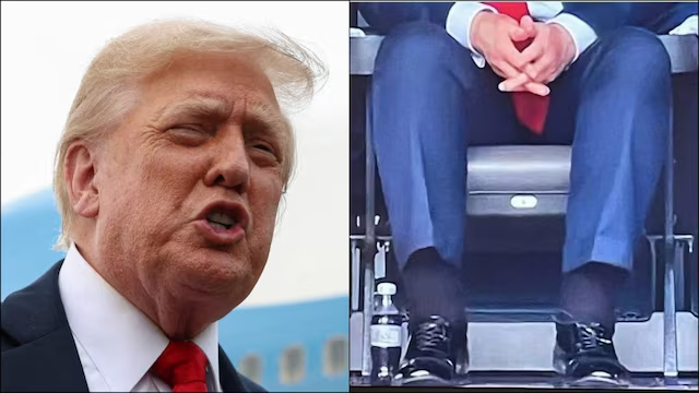 Trump diagnosed with mild chronic venous insufficiency, White House confirms